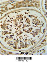 Formalin-fixed and paraffin-embedded human testis tissue reacted with OPLAH Antibody (N-term), which was peroxidase-conjugated to the secondary antibody, followed by DAB staining. This data demonstrates the use of this antibody for immunohistochemistry; clinical relevance has not been evaluated.