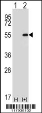 Western blot analysis of DDX39 (arrow) using rabbit polyclonal DDX39 Antibody (Center Y265) (Cat. #AP7451d). 293 cell lysates (2 ug/lane) either nontransfected (Lane 1) or transiently transfected (Lane 2) with the DDX39 gene.