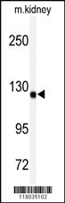 Western blot analysis of anti-ADAMTS19 Antibody (Center) (Cat.#AP7448c) in mouse kidney tissue lysates (35ug/lane). ADAMTS19 (arrow) was detected using the purified Pab.