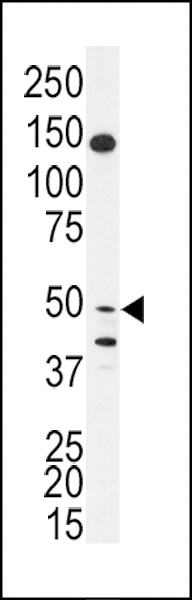 Western blot analysis of anti-BPIL1 Antibody (N-term)(Cat.#AP7427a) in SK-BR-3 cell line lysates (35ug/lane). BPIL1 (arrow) was detected using the purified Pab.