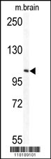 Western blot analysis of TECPR1 Antibody (C-term) (Cat.# AP7391b) in mouse brain tissue lysates (35ug/lane). TECPR1 (arrow) was detected using the purified Pab.