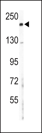 Western blot analysis of COL5A2 Antibody (N-term) (Cat.# AP7358a) in mouse lung tissue lysates (35ug/lane). COL5A2 (arrow) was detected using the purified Pab.