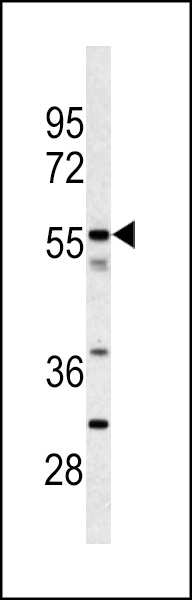 Western blot analysis of CPN2 antibody (N-term) (Cat.#AP7348a) in jurkat cell line lysates (35ug/lane). CPN2 (arrow) was detected using the purified Pab.