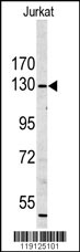 Western blot analysis of MYO1A antibody (Center S291) (Cat.#AP7343c) in Jurkat cell line lysates (35ug/lane). MYO1A (arrow) was detected using the purified Pab.