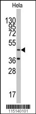Western blot analysis of anti-NARS2 Antibody (C-term) (Cat.#AP7585b) in Hela cell line lysates (35ug/lane).NARS2(arrow) was detected using the purified Pab.