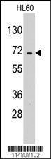 Western blot analysis of anti-EARS2 Pab (Cat.#AP7573b) in HL60 cell line lysates (35ug/lane).EARS2 (arrow) was detected using the purified Pab.