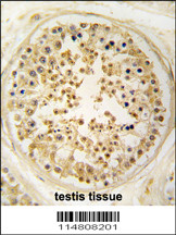 Formalin-fixed and paraffin-embedded human testis tissue reacted with EARS2 antibody (C-term) (Cat.#AP7573b), which was peroxidase-conjugated to the secondary antibody, followed by DAB staining. This data demonstrates the use of this antibody for immunohistochemistry; clinical relevance has not been evaluated.