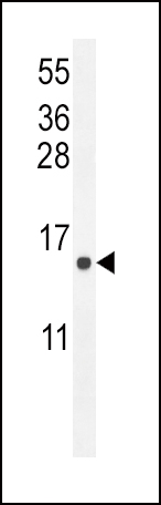 ATP6V0B Antibody (Center) (Cat. #AP10432c) western blot analysis in U251 cell line lysates (35ug/lane).This demonstrates the EKI2 antibody detected the EKI2 protein (arrow).