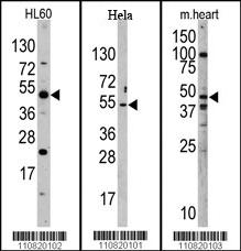 Western blot analysis of anti-PTDSR (N-term) Pab (RB10820) in mouse heart, Hela, and HL60 cell line lysates. PTDSR (N-term)(arrow) was detected using the purified Pab.