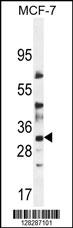 LYSMD4 Antibody (N-term) (Cat. #AP10422a) western blot analysis in MCF-7 cell line lysates (35ug/lane).This demonstrates the LYSMD4 antibody detected the LYSMD4 protein (arrow).