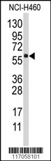 Western blot analysis of anti-CYP4F12 Antibody (C-term) (Cat.#AP7895b) in NCI-H460 cell line lysates (35ug/lane). CYP4F12(arrow) was detected using the purified Pab.
