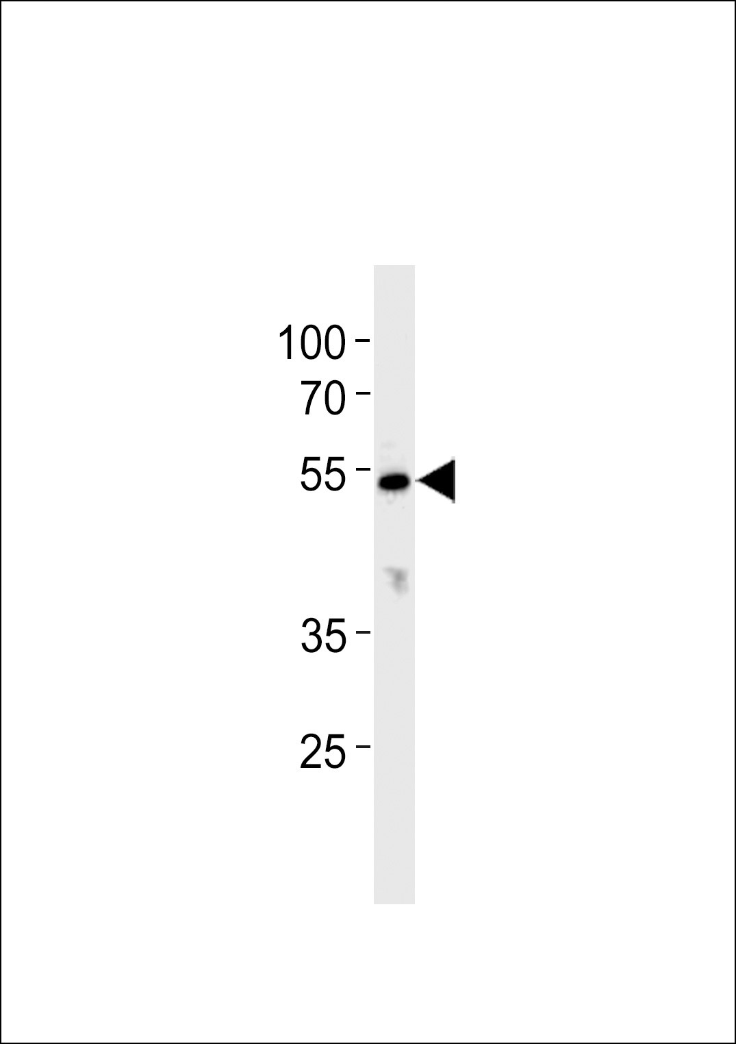 CYP26C1 Antibody (C-term) (Cat. #AP7892b) western blot analysis in K562 cell line lysates (35ug/lane).This demonstrates the CYP26C1 antibody detected the CYP26C1 protein (arrow).