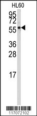 Western blot analysis of anti-CYP4Z1 Antibody (N-term)(Cat.#AP7886a) in HL60 cell line lysates (35ug/lane).CYP4Z1(arrow) was detected using the purified Pab.
