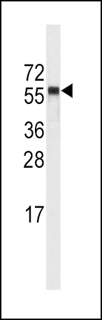 Western blot analysis of anti-CYP4A11 (4A22) Antibody (C-term) (Cat.#AP7884b) in NCI-H460 cell line lysates (35ug/lane).CYP4A11(arrow) was detected using the purified Pab.