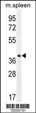 LHFPL5 Antibody (C-term) (Cat. #AP10415b) western blot analysis in mouse spleen tissue lysates (35ug/lane).This demonstrates the LHFPL5 antibody detected the LHFPL5 protein (arrow).