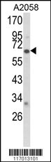Western blot analysis of CYP2F1 Antibody (C-term) (Cat. #AP7883b) in A2058 cell line lysates (35ug/lane).CYP2F1 (arrow) was detected using the purified Pab.