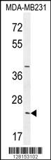 SYCE2 Antibody (N-term) (Cat. #AP10413a) western blot analysis in MDA-MB231 cell line lysates (35ug/lane).This demonstrates the SYCE2 antibody detected the SYCE2 protein (arrow).