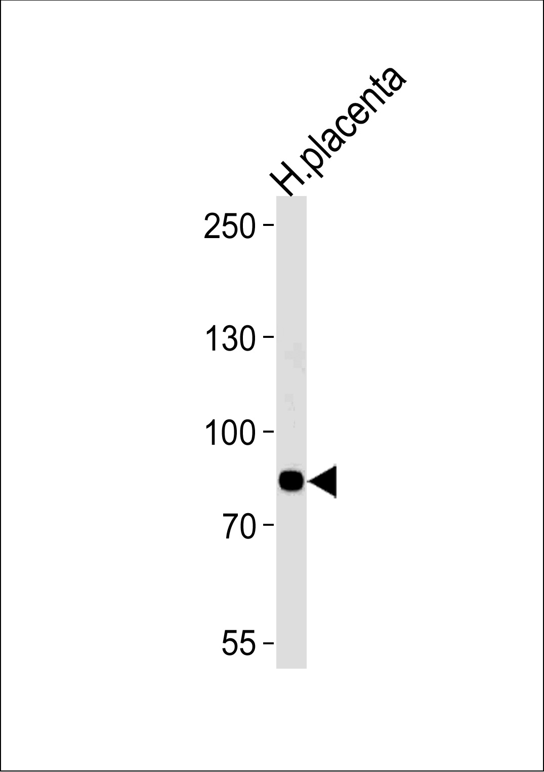 AMPD3 Antibody (Center) (Cat.# AP7869c) western blot analysis in human placenta tissue lysate (35ug/lane). This demonstrates that the AMPD3 antibody detected AMPD3 protein (arrow).