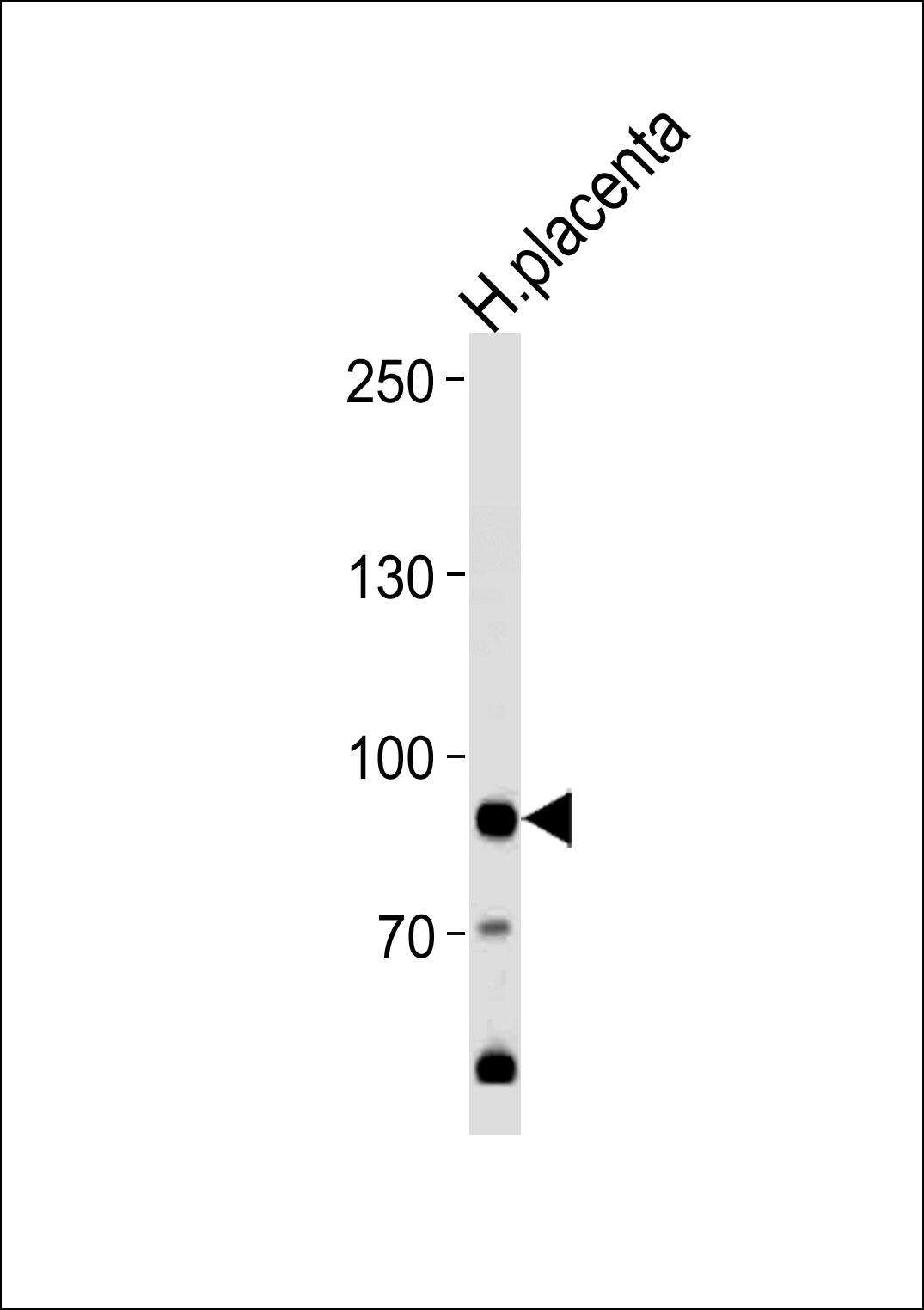 AMPD3 Antibody (Center) (Cat.# AP7869c) western blot analysis in human placenta tissue lysates (35ug/lane).This demonstrates the AMPD3 antibody detected the AMPD3 protein (arrow).