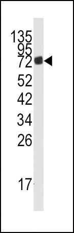 Western blot analysis of anti-AMPD3 Antibody (Center) (Cat.#AP7869c) in mouse lung tissue lysates (35ug/lane). AMPD3 (arrow) was detected using the purified Pab.