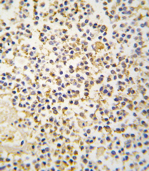 Formalin-fixed and paraffin-embedded human kideny tissue reacted with ALDH1A3 antibody (N-term), which was peroxidase-conjugated to the secondary antibody, followed by DAB staining. This data demonstrates the use of this antibody for immunohistochemistry; clinical relevance has not been evaluated.