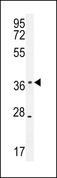 KLHDC1 Antibody (N-term) (Cat. #AP10855a) western blot analysis in mouse spleen tissue lysates (35ug/lane).This demonstrates the KLHDC1 antibody detected the KLHDC1 protein (arrow).
