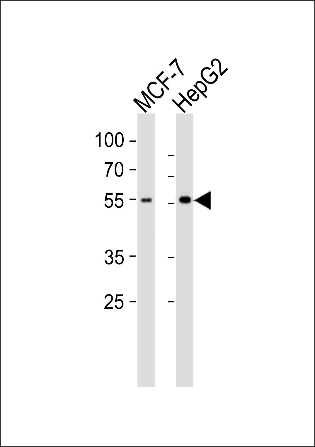Western blot analysis of lysates from MCF-7, HepG2 cell line (from left to right), using CYP2W1 Antibody (N-term)(Cat. #AP7792a). AP7792a was diluted at 1:1000 at each lane. A goat anti-rabbit IgG H&L(HRP) at 1:10000 dilution was used as the secondary antibody. Lysates at 20ug per lane.