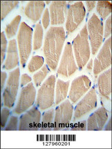 KLHDC1 antibody (N-term) (Cat. #AP10855a) immunohistochemistry analysis in formalin fixed and paraffin embedded human skeletal muscle followed by peroxidase conjugation of the secondary antibody and DAB staining. This data demonstrates the use of the KLHDC1 antibody (N-term) for immunohistochemistry. Clinical relevance has not been evaluated.