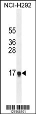 HEPN1 Antibody (N-term) (Cat. #AP10854a) western blot analysis in NCI-H292 cell line lysates (35ug/lane).This demonstrates the HEPN1 antibody detected the HEPN1 protein (arrow).