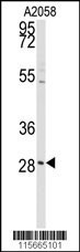 Western blot analysis of anti-PRKCDBP Antibody (Center) (Cat.#AP7787c) in A2058 cell line lysates (35ug/lane). PRKCDBP (arrow) was detected using the purified Pab.