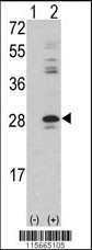 Western blot analysis of PRKCDBP (arrow) using rabbit polyclonal PRKCDBP Antibody (Center) (Cat. #AP7787c). 293 cell lysates (2 ug/lane) either nontransfected (Lane 1) or transiently transfected with the PRKCDBP gene (Lane 2) (Origene Technologies).
