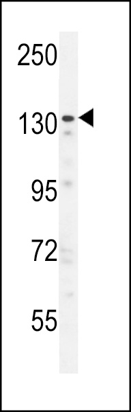 ZNF536 Antibody (N-term) (Cat. #AP10852a) western blot analysis in U251 cell line lysates (35ug/lane).This demonstrates the ZNF536 antibody detected the ZNF536 protein (arrow).