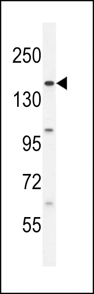 BCORL1 Antibody (N-term) (Cat. #AP10847a) western blot analysis in HL-60 cell line lysates (35ug/lane).This demonstrates the BCORL1 antibody detected the BCORL1 protein (arrow).