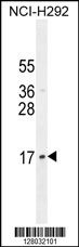 LLPH Antibody (Center) (Cat. #AP10843c) western blot analysis in NCI-H292 cell line lysates (35ug/lane).This demonstrates the LLPH antibody detected the LLPH protein (arrow).