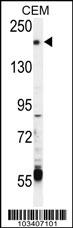 CHAK2 Antibody (H332) (Cat. #AP8053c) western blot analysis in CEM cell line lysates (35ug/lane).This demonstrates the CHAK2 antibody detected the CHAK2 protein (arrow).