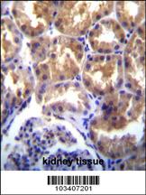TRPM6(CHAK2) Antibody (Center) (Cat. #AP8053c)immunohistochemistry analysis in formalin fixed and paraffin embedded human kidney tissue followed by peroxidase conjugation of the secondary antibody and DAB staining.This data demonstrates the use of TRPM6 Antibody (CHAK2) (Center) for immunohistochemistry. Clinical relevance has not been evaluated.
