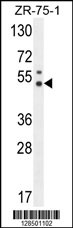 PUS3 Antibody (N-term) (Cat. #AP10835a) western blot analysis in ZR-75-1 cell line lysates (35ug/lane).This demonstrates the PUS3 antibody detected the PUS3 protein (arrow).