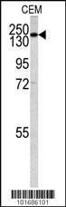 Western blot analysis of PI3KC2G antibody (N-term) (Cat.# AP8012a) in CEM cell line lysates (35ug/lane). PI3KC2G (arrow) was detected using the purified Pab.