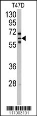 Western blot analysis of anti-CYP2C8 Antibody (N-term) (Cat.#AP7995a) in T47D cell line lysates (35ug/lane). CYP2C8(arrow) was detected using the purified Pab.