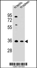 ASB17 Antibody (C-term) (Cat. #AP10825b) western blot analysis in mouse testis,spleen tissue lysates (35ug/lane).This demonstrates the ASB17 antibody detected the ASB17 protein (arrow).