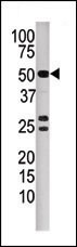 Western blot analysis of anti-PPP3CB Pab (Cat. #AP8464a) in mouse kidney tissue lysate. PPP3CB(arrow) was detected using the purified Pab.