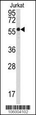 Western blot analysis of anti-PPP3CB Antibody (N-term) (Cat.#AP8464a) in Jurkat cell line lysates (35ug/lane). PPP3CB(arrow) was detected using the purified Pab.