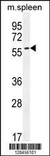 CE037 Antibody (C-term) (Cat. #AP10821b) western blot analysis in mouse spleen tissue lysates (35ug/lane).This demonstrates the CE037 antibody detected the CE037 protein (arrow).