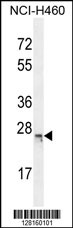 CP045 Antibody (Center) (Cat. #AP10819c) western blot analysis in NCI-H460 cell line lysates (35ug/lane).This demonstrates the CP045 antibody detected the CP045 protein (arrow).