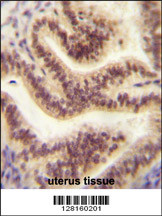 CP045 antibody (Center) (Cat. #AP10819c) immunohistochemistry analysis in formalin fixed and paraffin embedded human uterus tissue followed by peroxidase conjugation of the secondary antibody and DAB staining. This data demonstrates the use of the CP045 antibody (Center) for immunohistochemistry. Clinical relevance has not been evaluated.