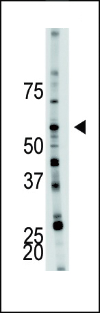 The anti-PFKFB4 Pab (Cat. #AP8154c) is used in Western blot to detect PFKFB4 in mouse brain tissue lysate.