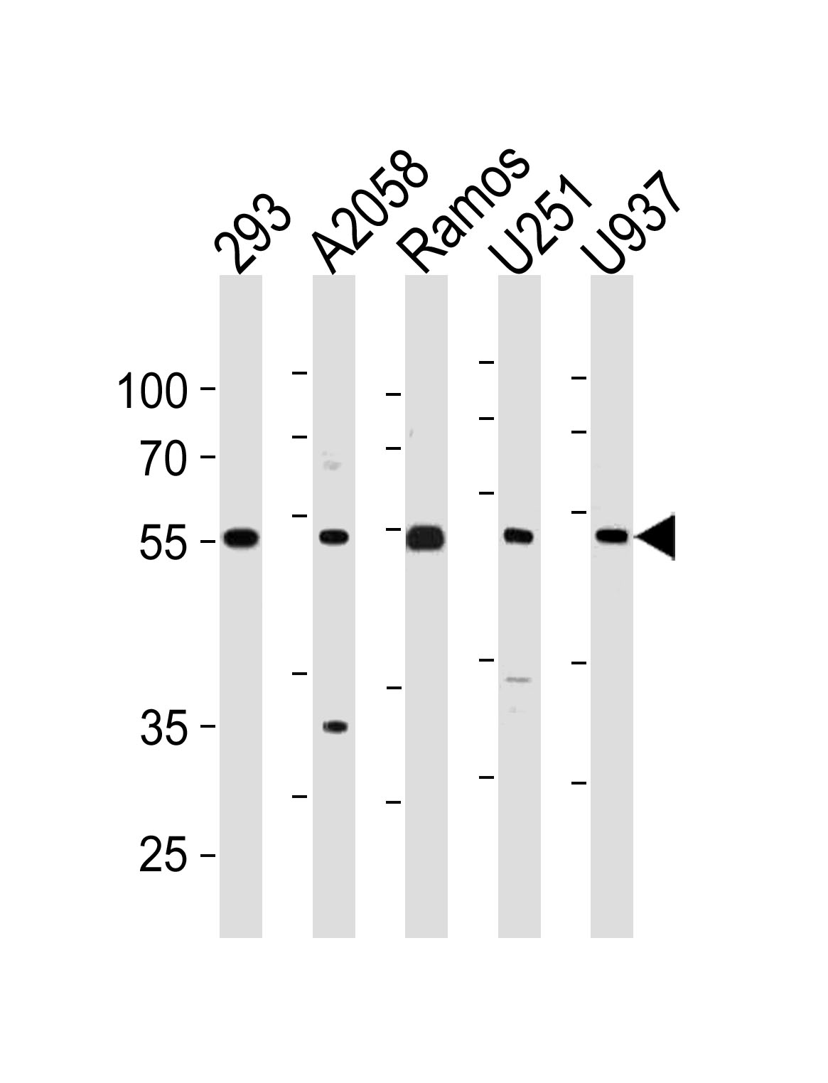 CDCA7L Antibody (C-term) (Cat. #AP20468b) western blot analysis in 293,A2058,Ramos,U251,U937 cell line lysates (35ug/lane).This demonstrates the CDCA7L antibody detected the CDCA7L protein (arrow).