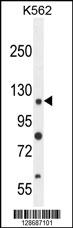 ANR52 Antibody (N-term) (Cat. #AP10808a) western blot analysis in K562 cell line lysates (35ug/lane).This demonstrates the ANR52 antibody detected the ANR52 protein (arrow).