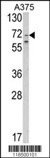 Western blot analysis of SLC23A2 Antibody (N-term) (Cat. #AP8652a) in A375 cell line lysates (35ug/lane). SLC23A2 (arrow) was detected using the purified Pab.
