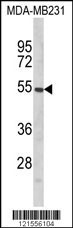 Western blot analysis of PTAR1 Antibody (Center) (Cat. #AP8622c) in MDA-MB231 cell line lysates (35ug/lane). PTAR1 (arrow) was detected using the purified Pab.